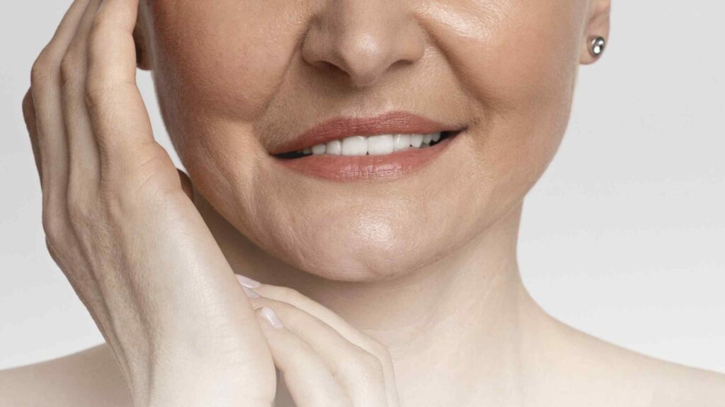Parálisis Facial