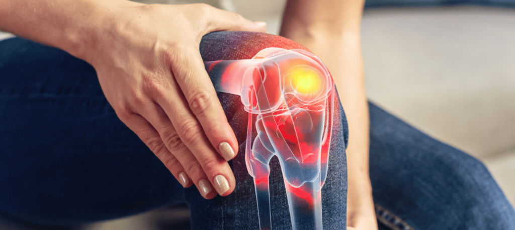 Dolor de Rodilla