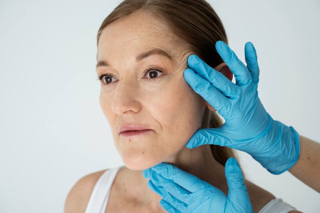 Parálisis Facial